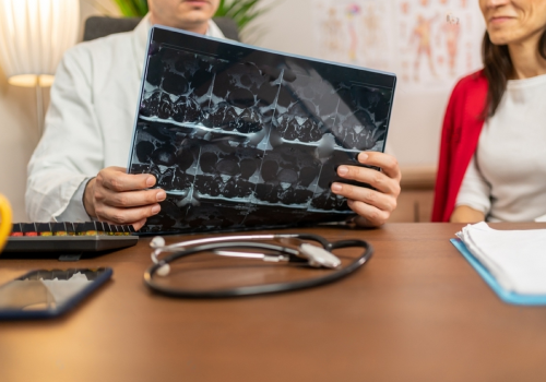 best multiple sclerosis doctors in jayanagar bangalore