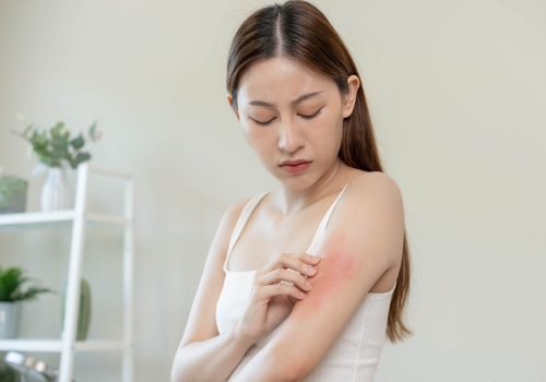 best skin disease treatment in jayanagar bangalore